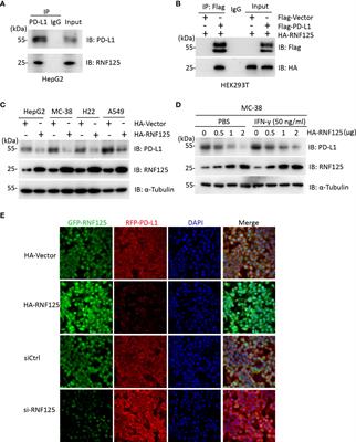Ubiquitin ligase RNF125 targets PD-L1 for ubiquitination and degradation